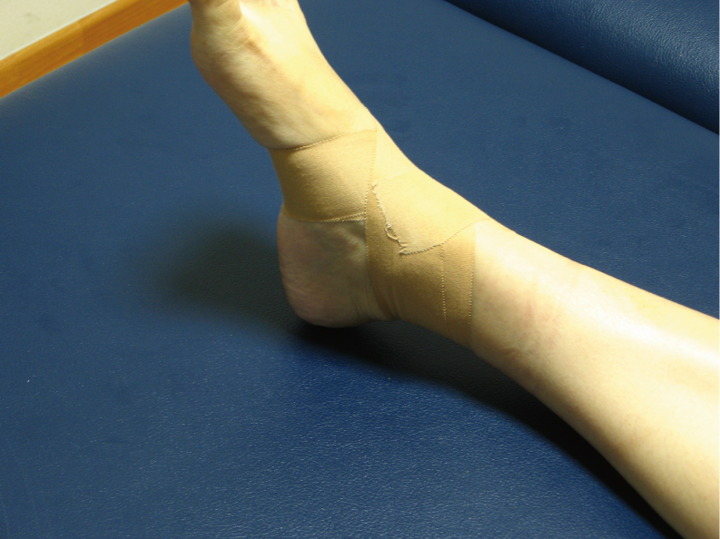 sports taping of ankle